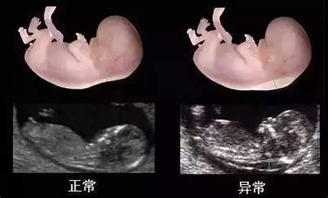 怀孕7周胎宝宝与准妈妈的变化