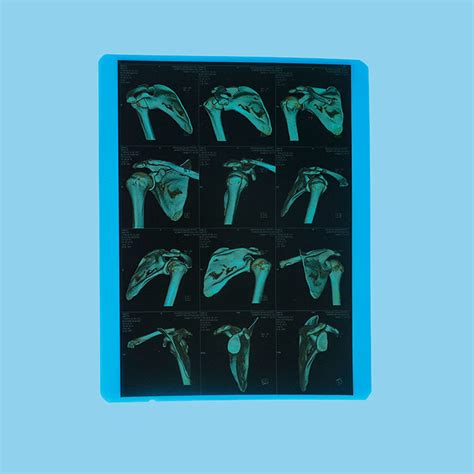 医用胶片的唯美快手说说