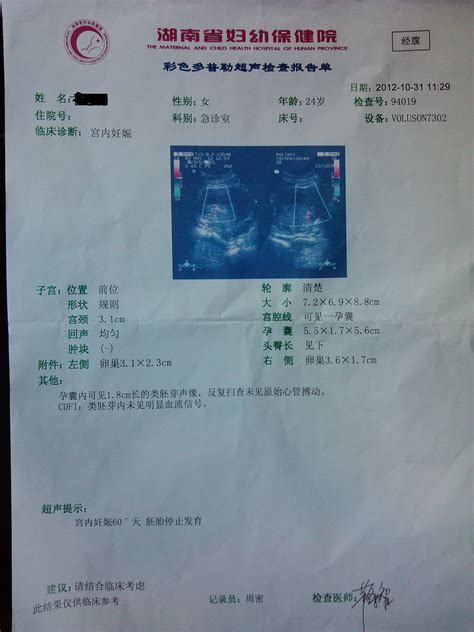 孕期第一次产检要检查什么