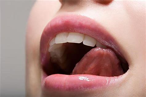 嘴唇干裂是什么原因引起的?怎么治