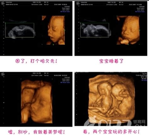 14周3天的胎儿图片