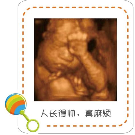 胎儿发育需要做哪些检查