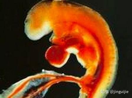 怀孕四十六天胎囊发育正常吗