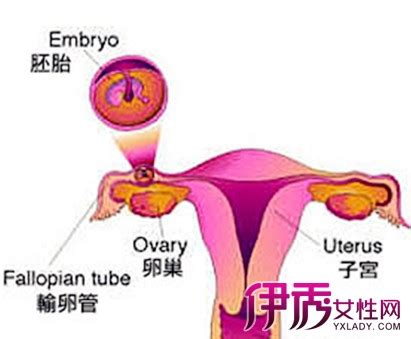 宫外孕微创手术后怎样调理