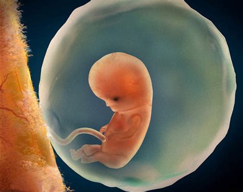 什么情况会引起胚胎停育