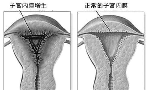 子宫大小43*42*40正常吗