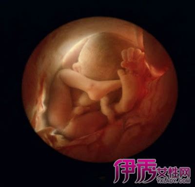怀孕三个月男胎儿图