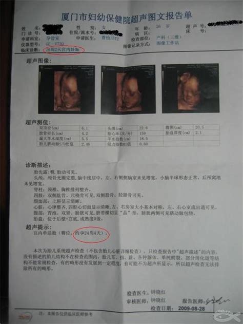 广州市妇婴医院四维彩超