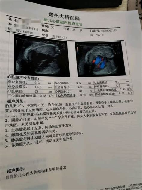 中山博爱医院四维彩超多少钱