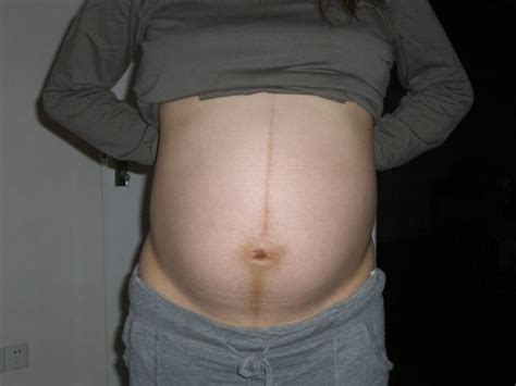 孕11周肚子标准图