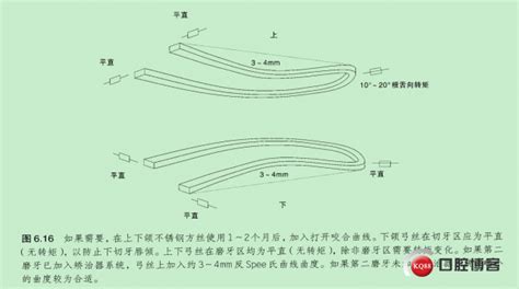 自鎖托槽與現代滑動直絲弓矯正技術