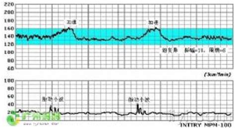 胎心率一直在150上下浮动