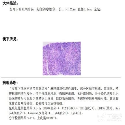 5大食物让准妈不再贫血