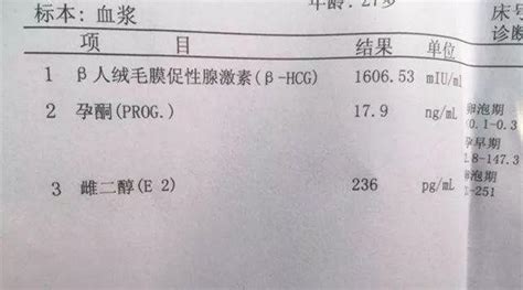 怀孕35天b超能查出来吗