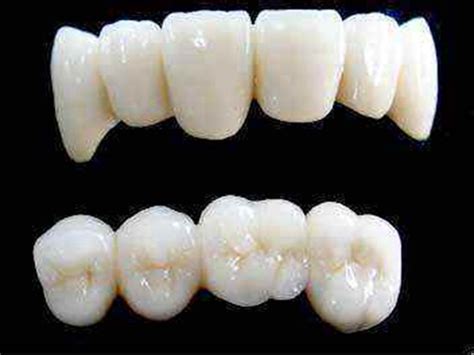 对牙齿有什么影响,茶叶含在嘴巴对牙齿有什么坏处吗