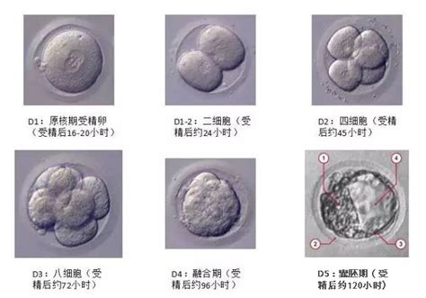 试管婴儿胚胎移植的过程
