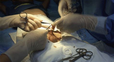 取环多少钱大概要几分钟