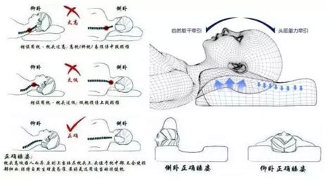 肩膀落枕最佳治疗方法