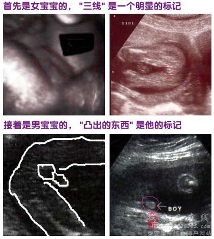 怀孕14周胎儿彩超图片