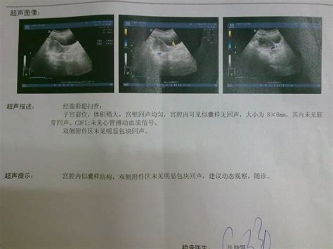 怀孕20周的彩超报告图片