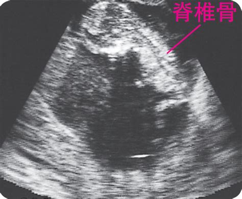 孕8周超声图像看胎儿位置