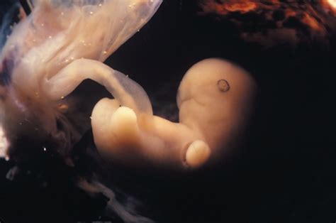 怀孕十月胎儿发育过程图解