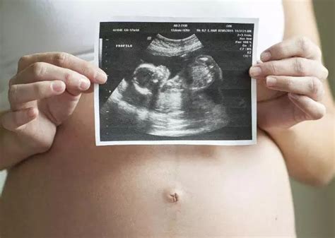 24周胎儿正常动是怎么样的