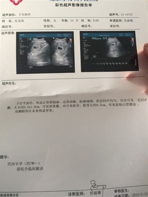 孕六周胎芽未见胎心