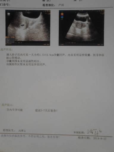 胎芽胎心