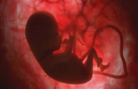 胎儿在子宫里过的是小资生活