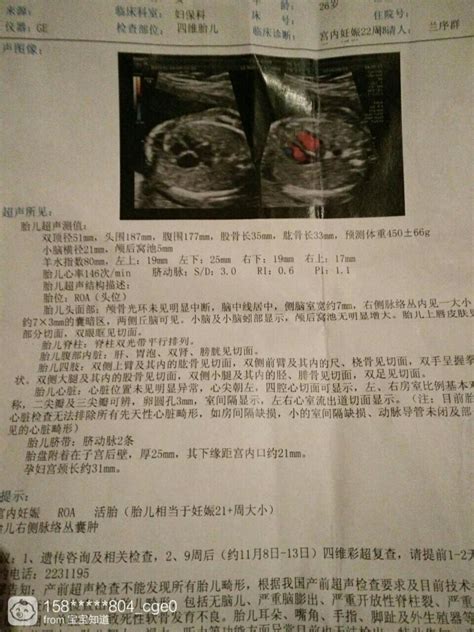 怀孕6个月四维彩超图片