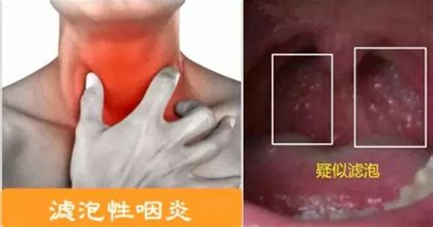 嗓子不舒服的说说[汇总55条]