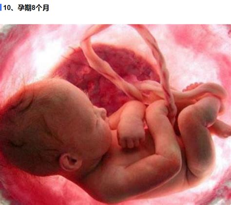23周胎儿肾发育好了吗