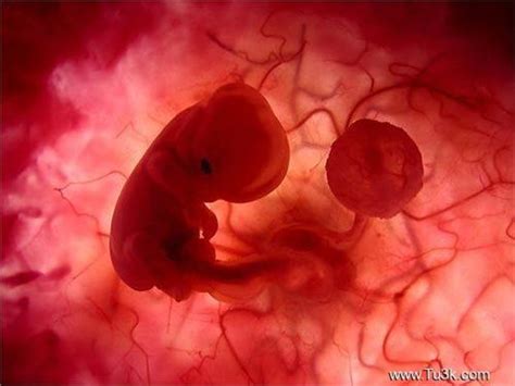 做彩超图片看胎儿性别？？