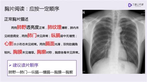 乳房痛看啥科