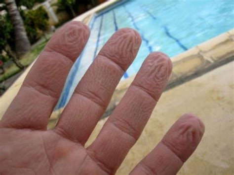 手指泡水为什么起皱,为什么人的手指浸水就会起皱
