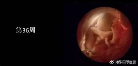 股骨长是胎儿的什么