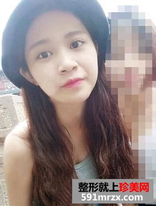 打瘦脸针会不会显老