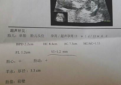 13周nt值是7.2正常吗