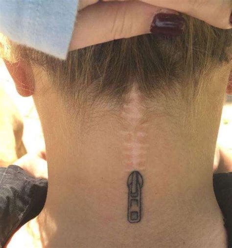 疤痕体质的人能纹身么,你是疤痕体质么