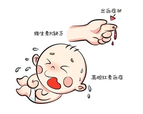 宝宝缺乏维生素b1的症状是什么