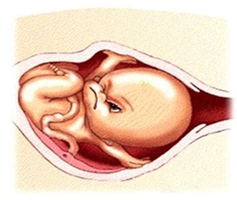 胎儿宫内窘迫时,孕妇一般采取的卧位是?