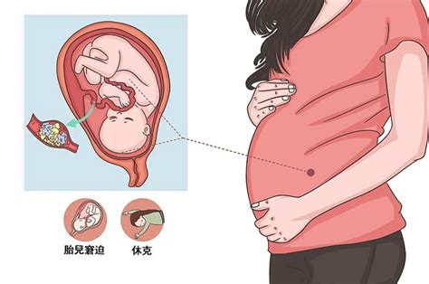 羊水里有血b超能看出来吗