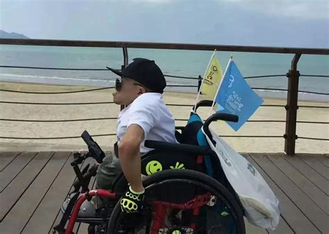 成骨不全症能自愈吗