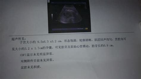 b超早期孕囊50天的尺寸
