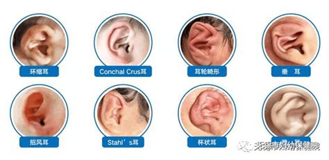 孩子的耳朵要常检查保健康