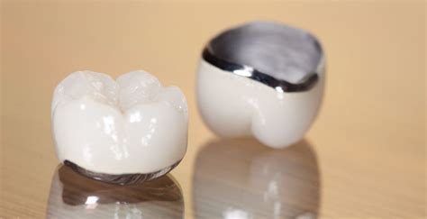 核磁共振能戴陶瓷假牙吗