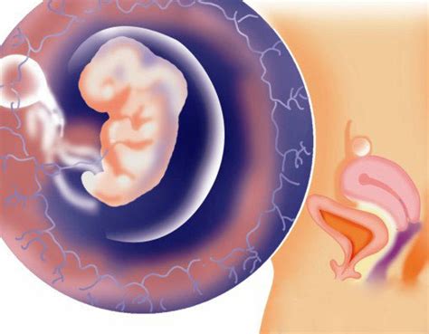 孕期胎教运动