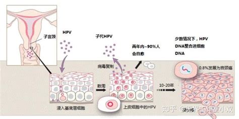 hpv能在宫腔存活吗