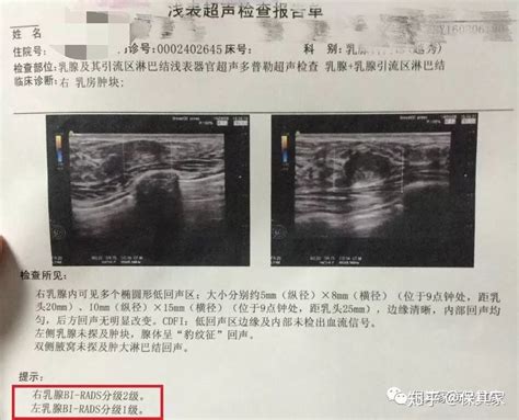 7周乳腺发育严重不